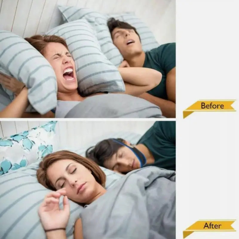 Outdoor Gym Equipment Fitness Anti-Snoring Chin Strap Mouth Guards Stop Bruxism Anti-Nasnoring Solutions Breathe Anti-snoring